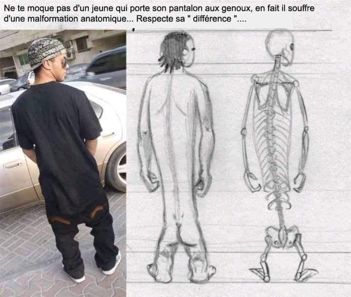 anatomicka anomalie.jpg